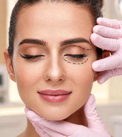 Eyelid Surgery